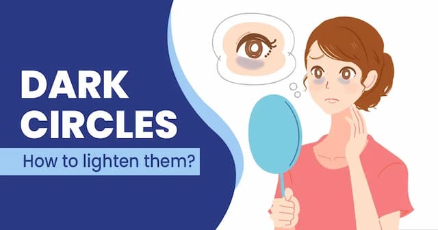 How to get rid of Dark Circles?
