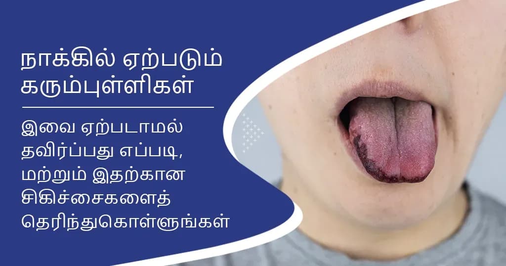 நாக்கில் ஏற்படும்கரும்புள்ளிகள்–அறிகுறிகள்,காரணங்கள், மற்றும்சிகிச்சைகள்