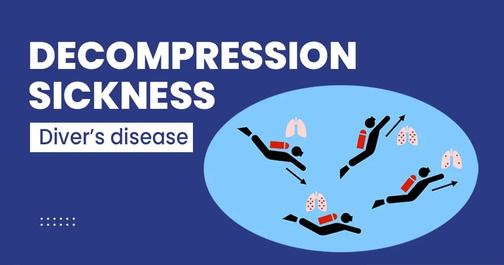 Decompression Sickness - All About It