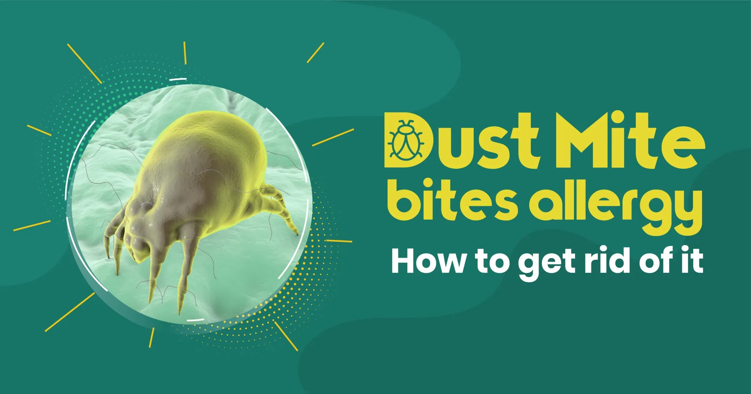 Dust Mite Bites Allergy - How to Get Rid of It? 