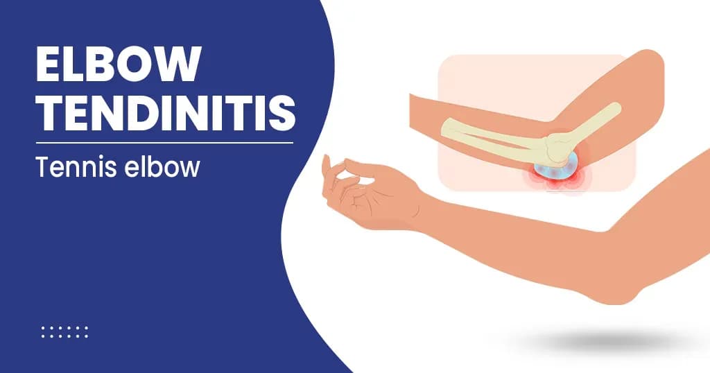 Elbow Tendinitis  Causes, Symptoms, Treatments and Prevention 