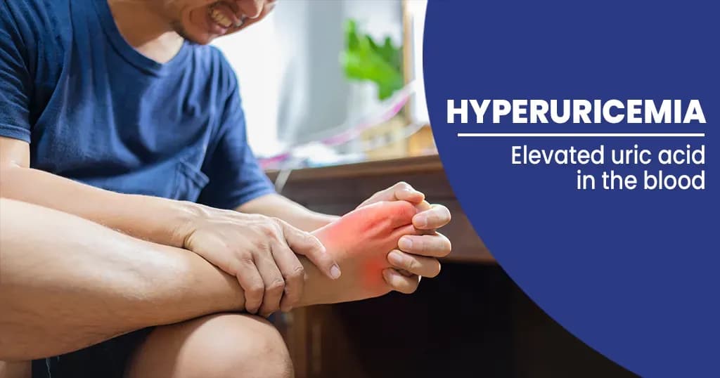 Hyperuricemia  Symptoms, Causes, and Treatments