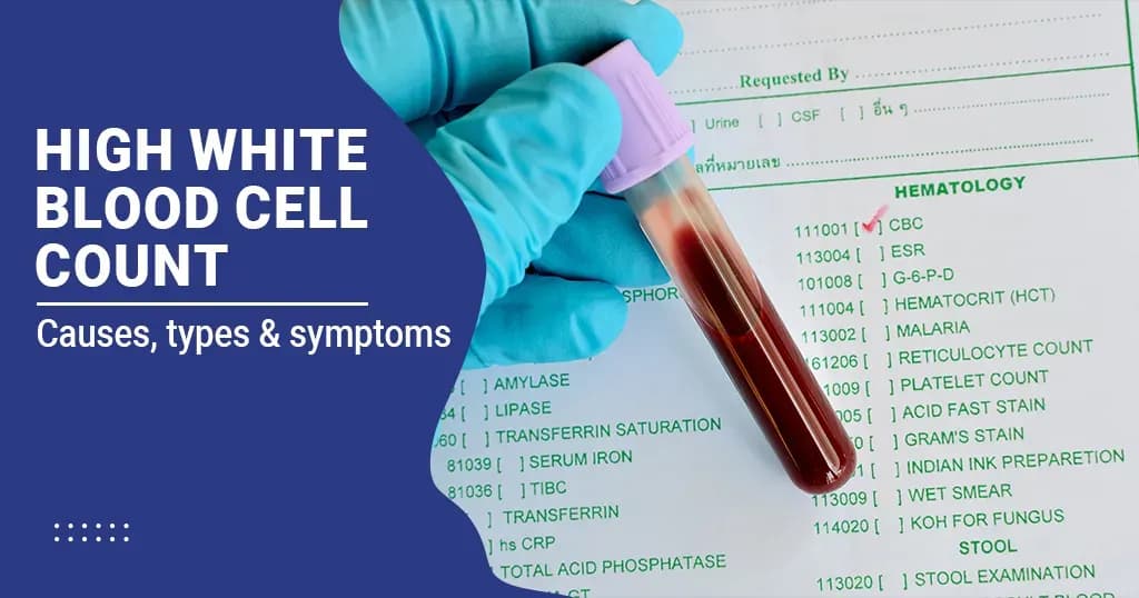 What to know about high white blood cell count?