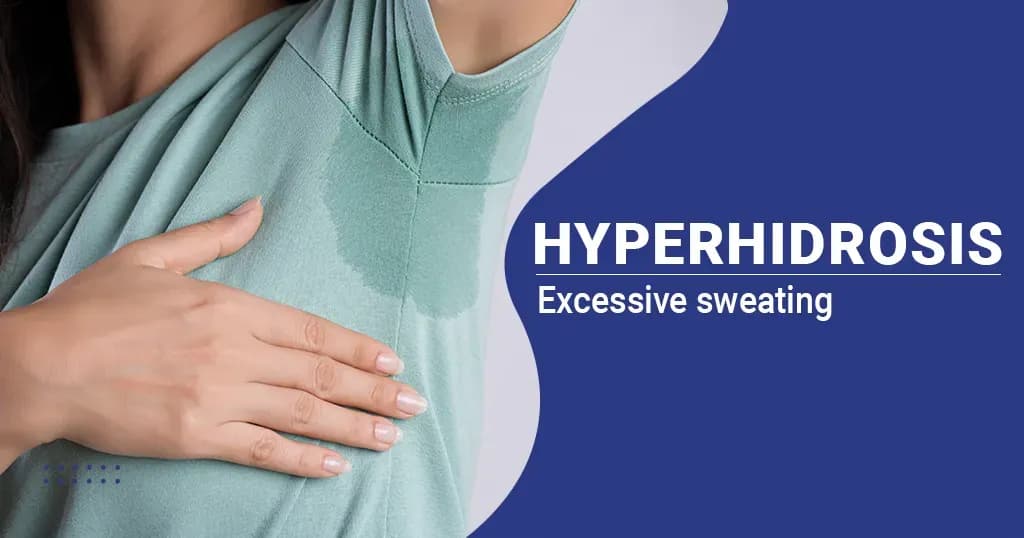 Hyperhidrosis Causes, Symptoms, Treatments and More 