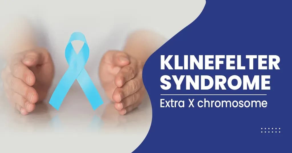 What is Klinefelter Syndrome - Its Causes, Symptoms and More