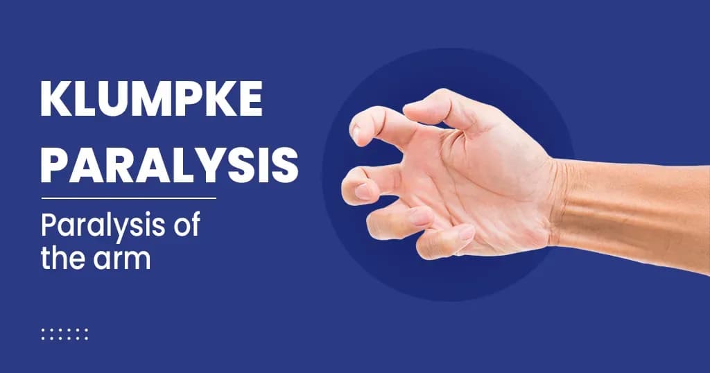 Klumpke Paralysis 