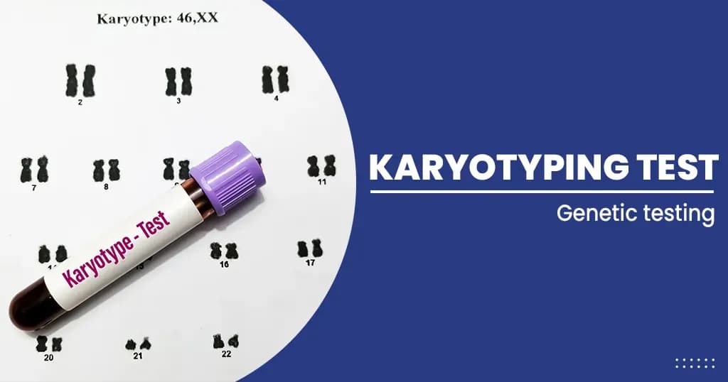 Karyotyping Test  Purpose and Procedure 