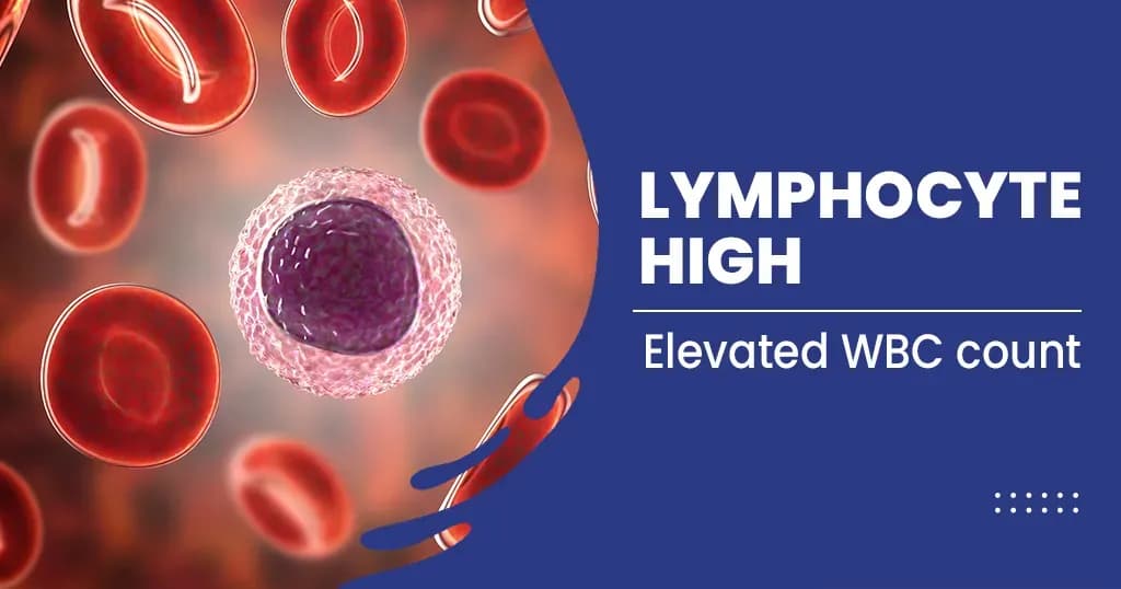 High Lymphocytes Causes -  Symptoms of High Lymphocytes Explained
