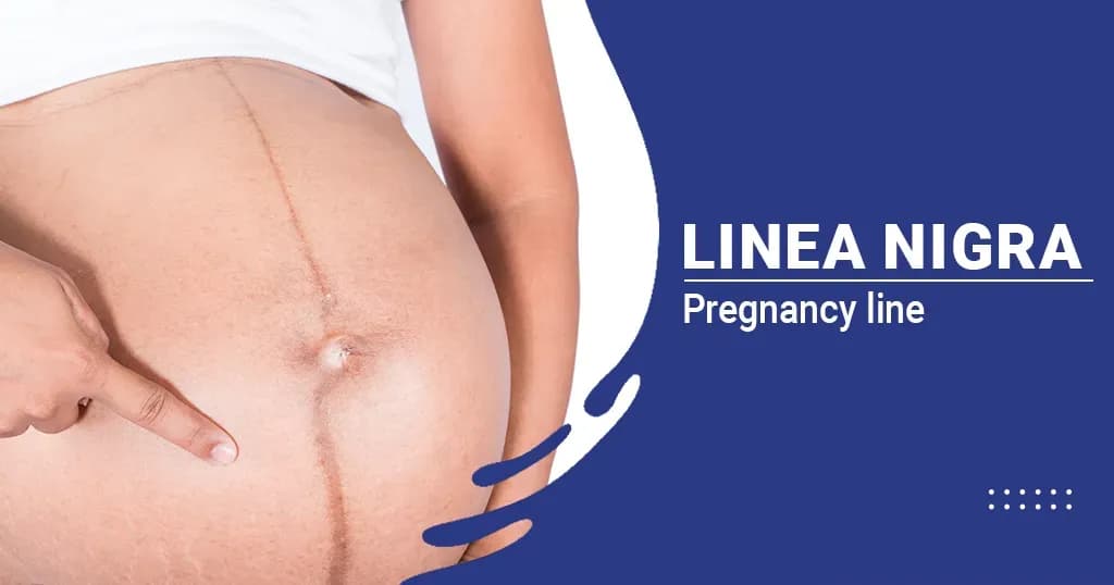 Linea Nigra Causes and Prevention 