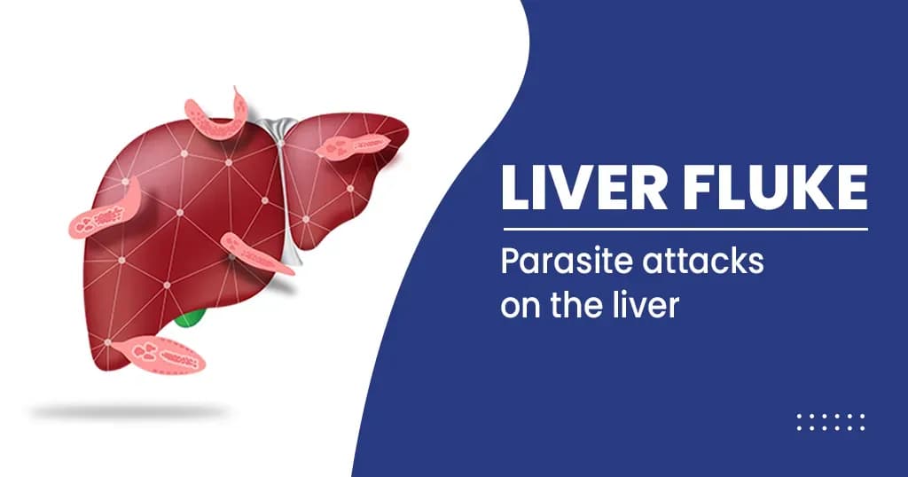 Liver Fluke Symptoms, Causes, Risk Factors, Treatments and More