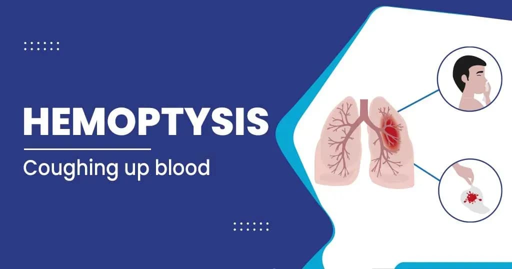Hemoptysis Diagnosis and Treatment