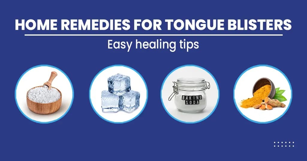 Home Remedies of Tongue Blisters 
