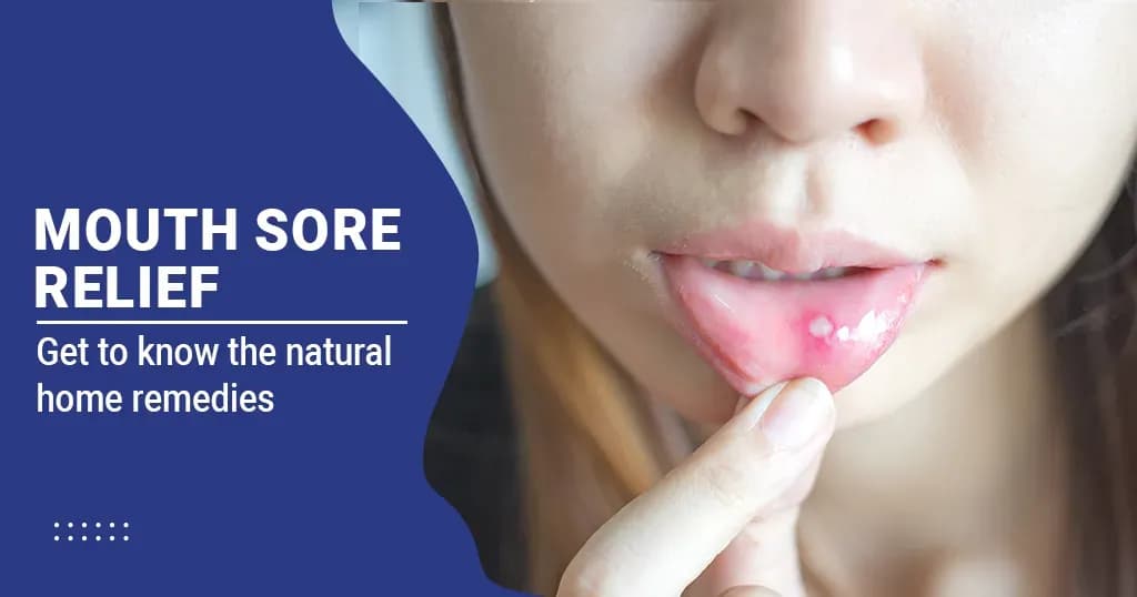 Canker Sore (Aphthous Ulcer): Natural Remedies for Mouth Sore Relief