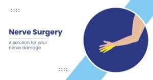 Nerve Surgery - Risks, Procedure, and Preparation
