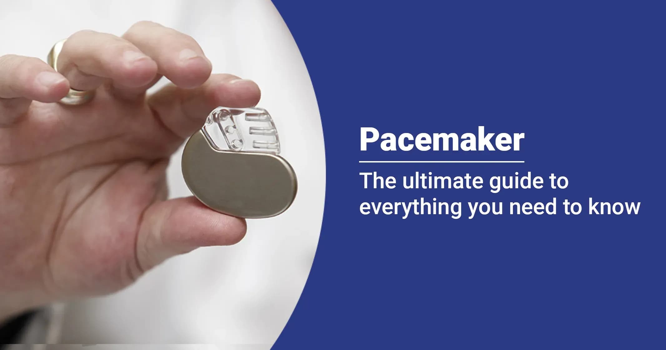 Pacemaker - Everything You Need to Know