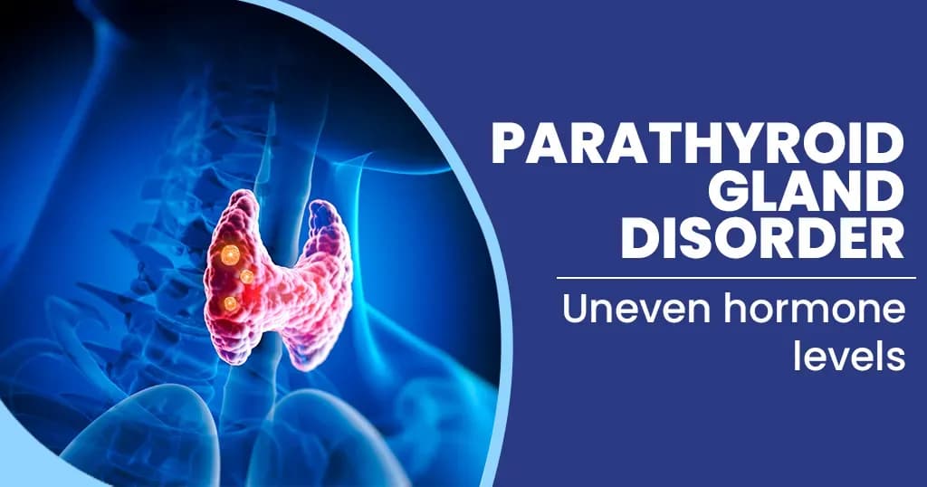 Parathyroid Gland Disorders Causes, Symptoms, Diagnosis and Treatment 