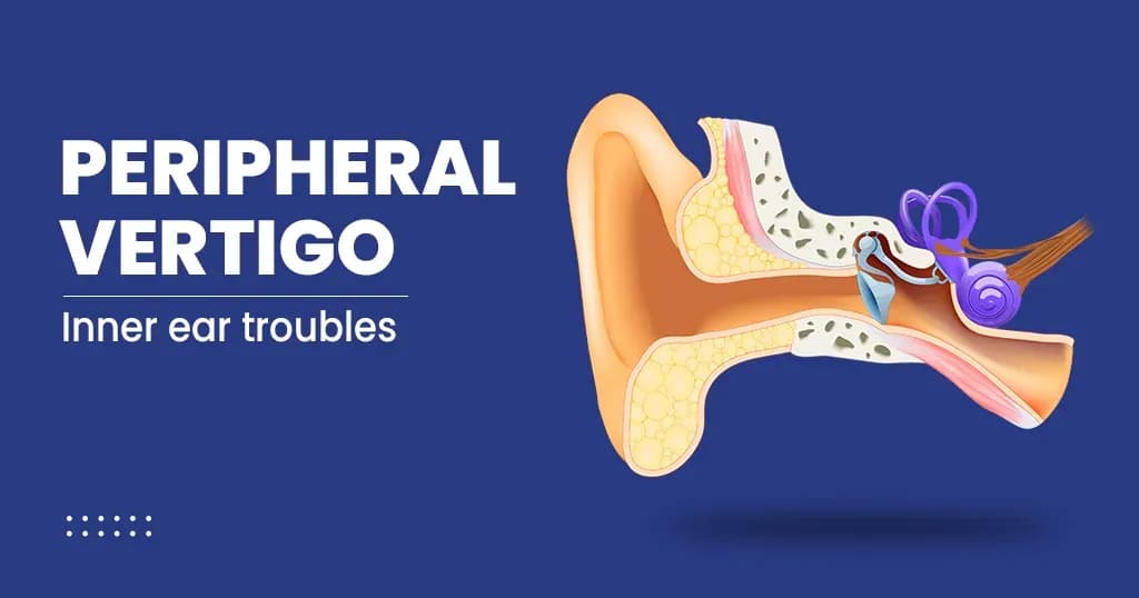 Peripheral Vertigo Causes, Diagnosis and Treatments 