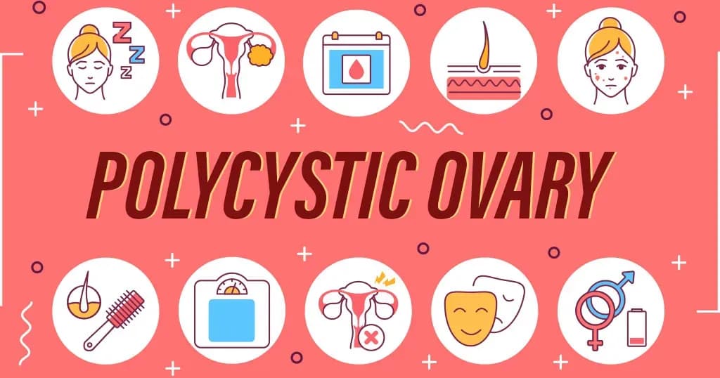 PCOS Symptoms | Check PCOS Symptoms and Treatment here