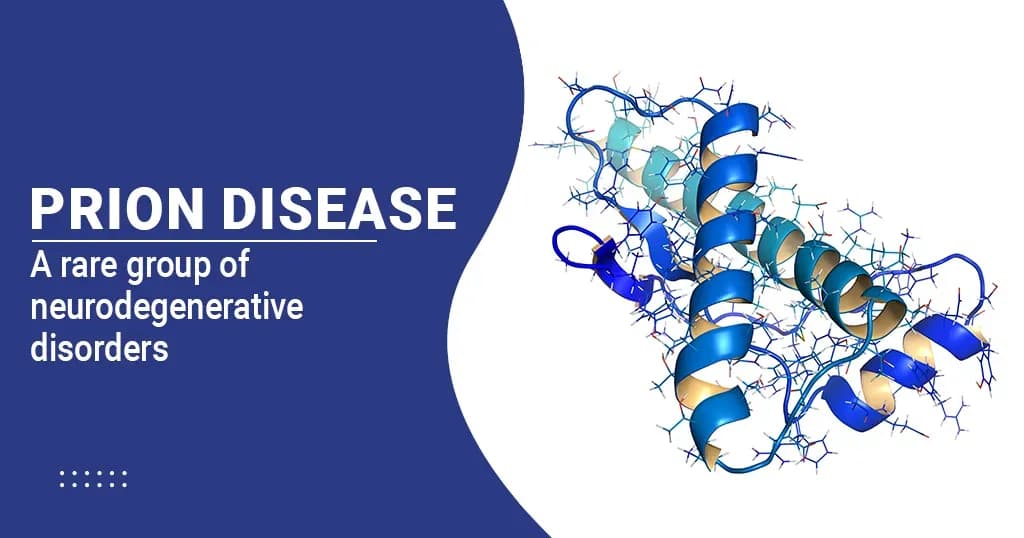 Prion Disease Causes, Symptoms, Treatment and More  