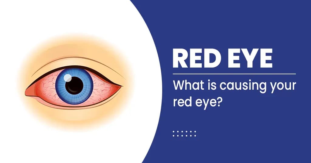 Red Eye