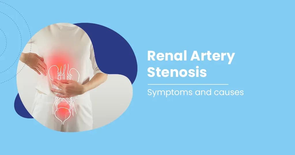 Renal Artery Stenosis Causes, Symptoms and Treatment 