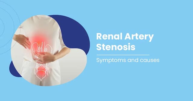 Renal Artery Stenosis Causes, Symptoms and Treatment 