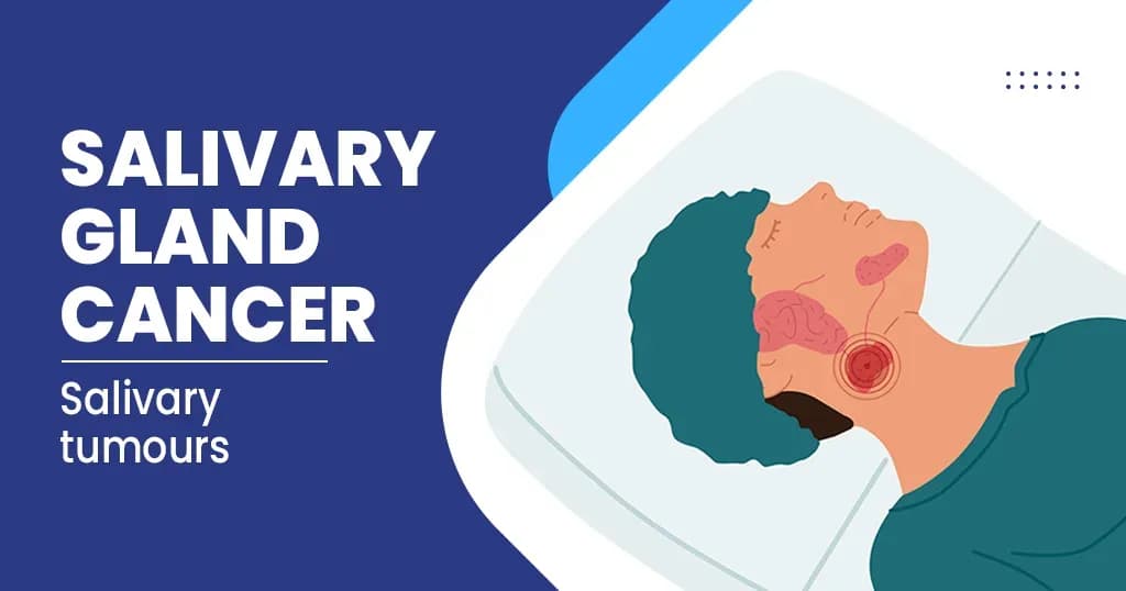 Salivary Gland Cancer?