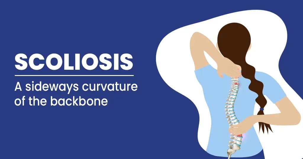 Scoliosis Causes, Symptoms and Treatment   