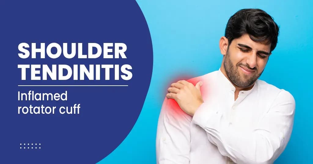 Shoulder Tendinitis Causes, Symptoms, Treatments, and Prevention 