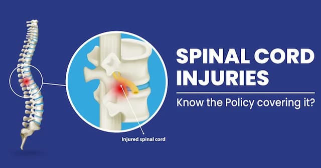 Understanding spinal cord injuries and treatment 