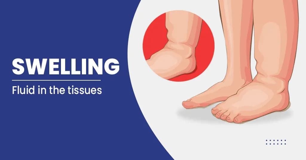 Swelling
