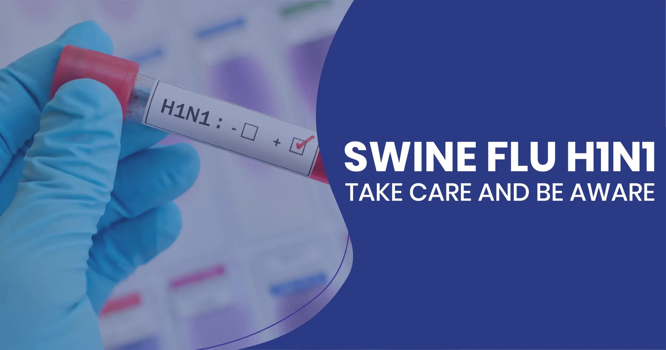 Symptoms and treatments of Swine Flu (H1N1 Flu)