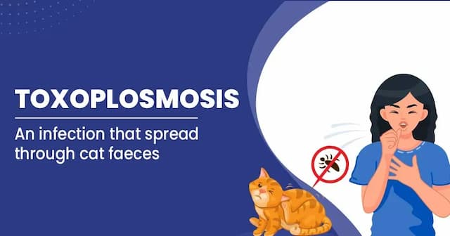 Toxoplasmosis Causes, Symptoms and Treatments
