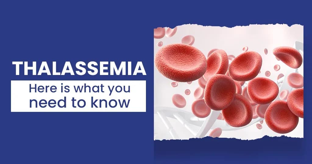 Thalassemia Causes and Treatment   
