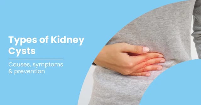Kidney Cyst Causes, Symptoms and Treatments