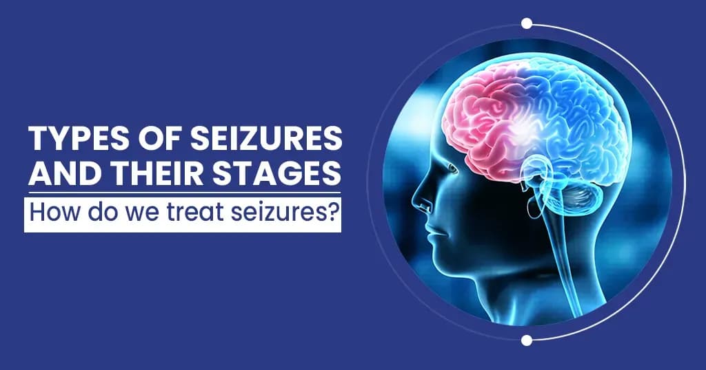 Types of Seizure and their Stages