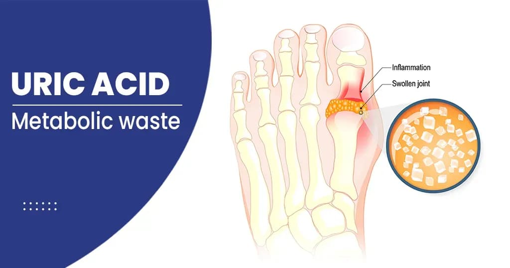 Natural Remedies to lower your Uric Acid Levels 