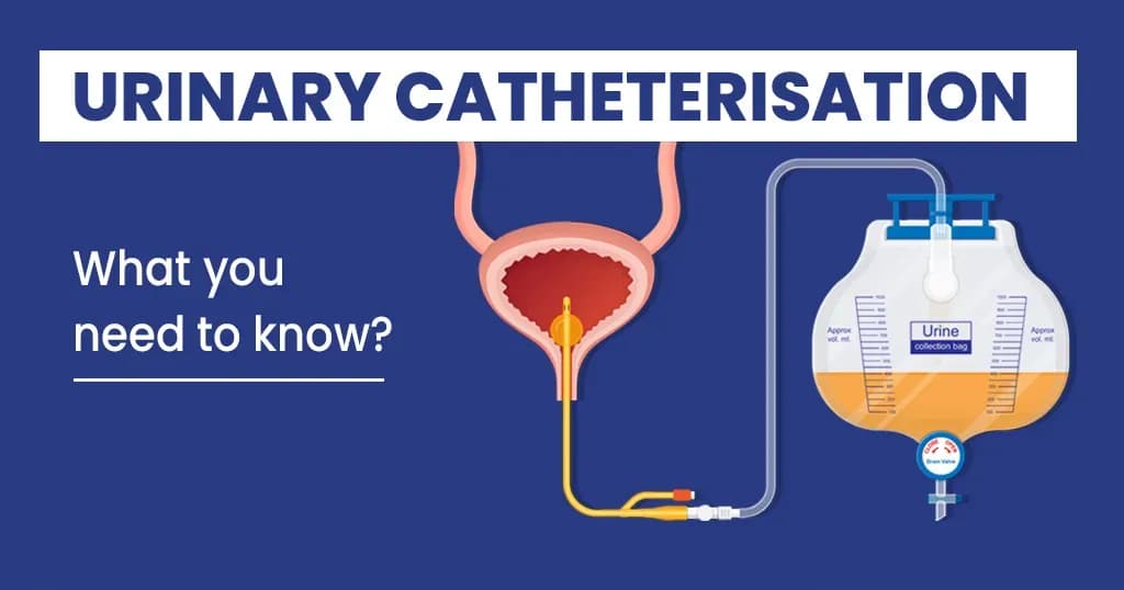 Urinary Catheterization Uses, Types and Complications