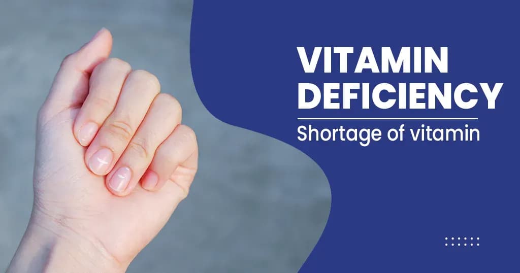 Vitamin Deficiency Symptoms, Causes, Complications and Treatments 