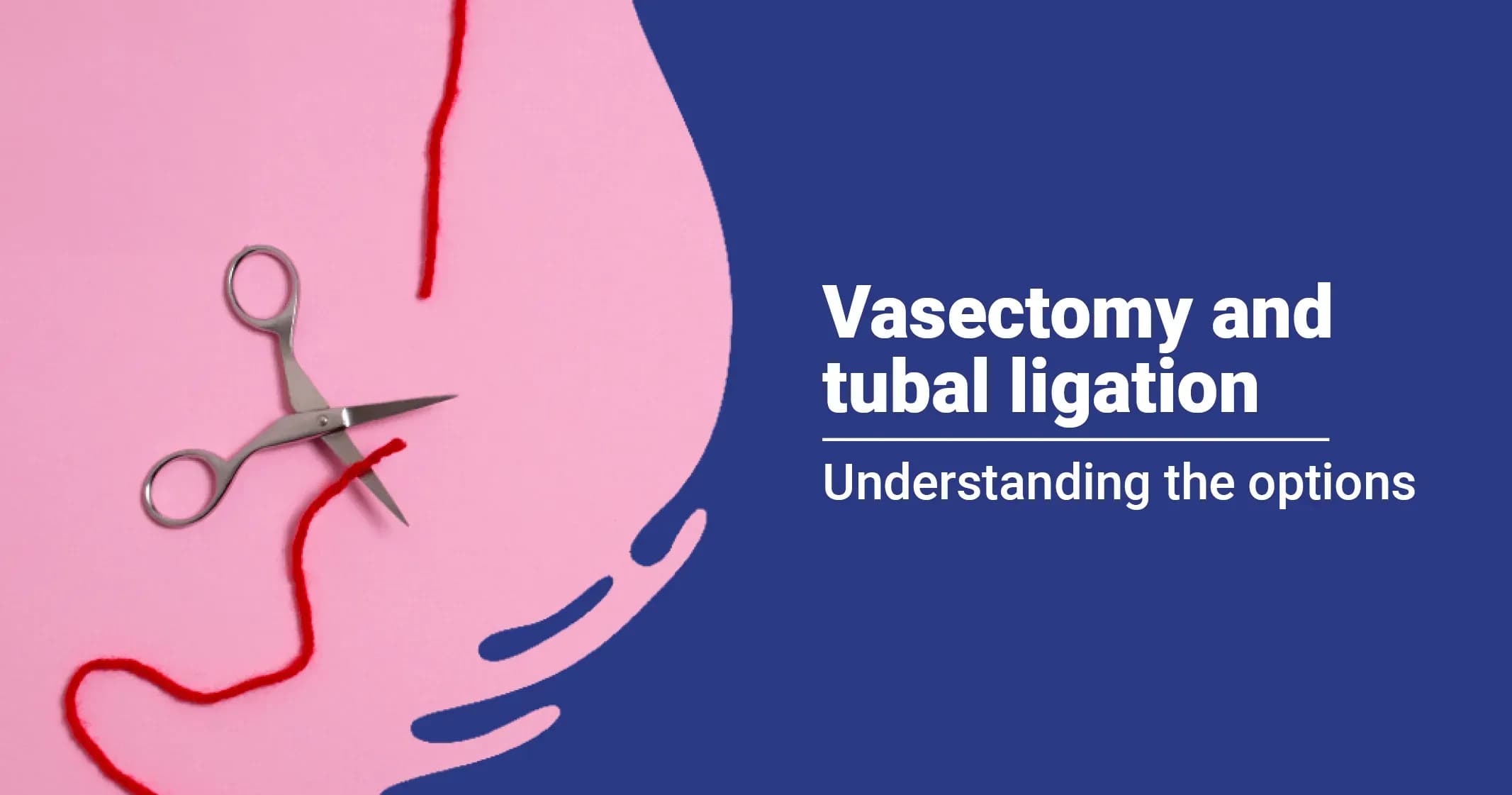 Vasectomy and Tubal Ligation: Understanding the Options 