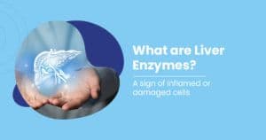 Elevated Liver Enzymes - Causes And Prevention