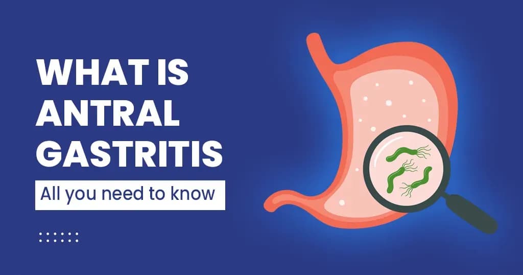 What is Antral Gastritis?