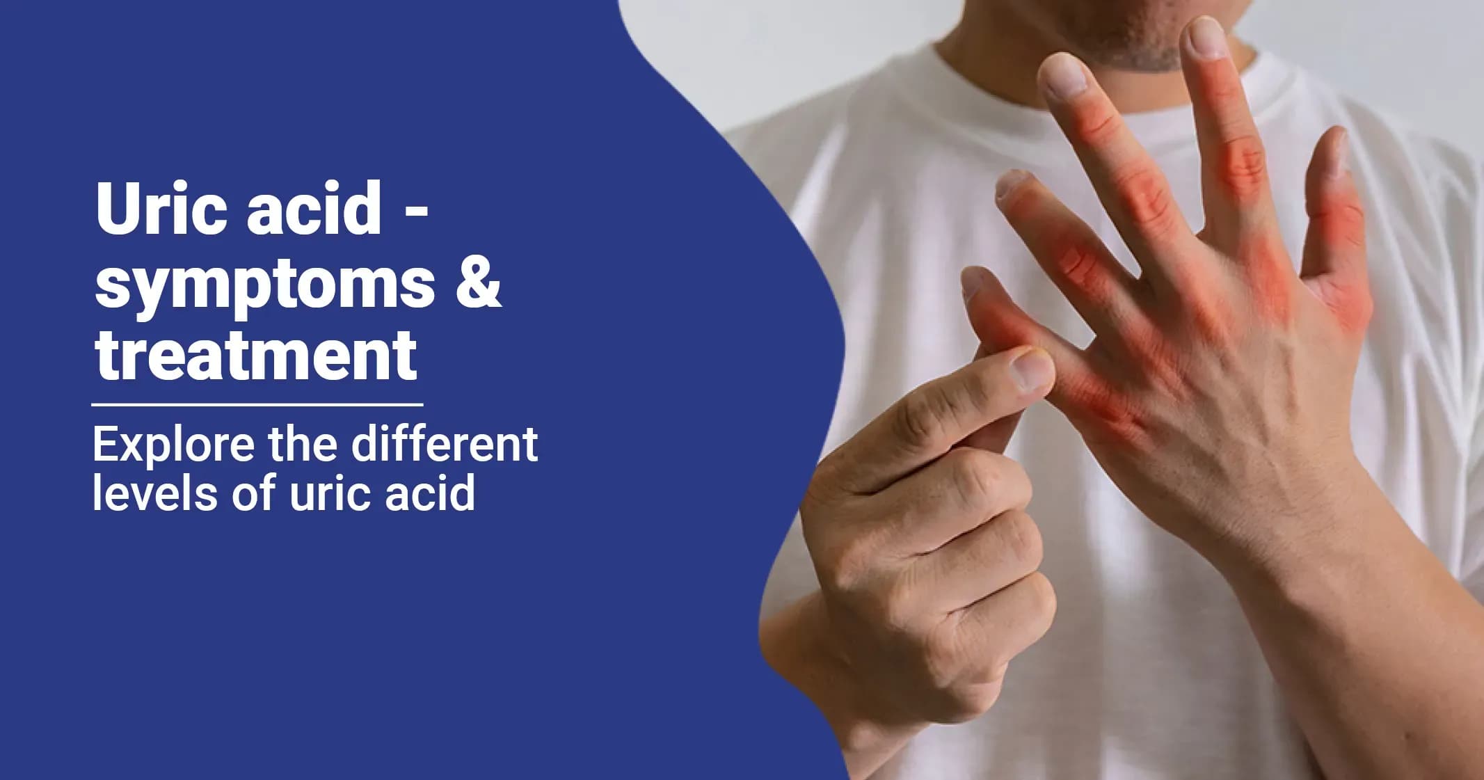 Uric Acid Causes, Prevention & Treatment   