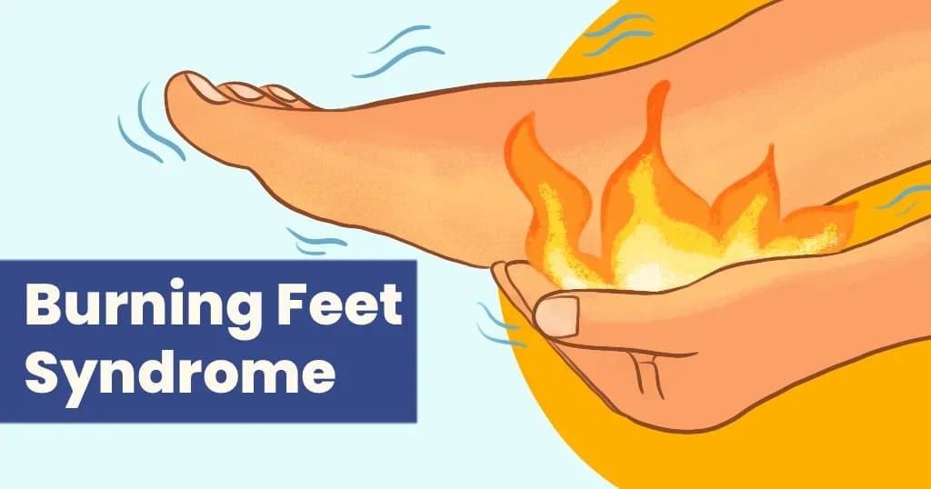 Burning Feet Syndrome Causes, Diagnosis and Treatments 