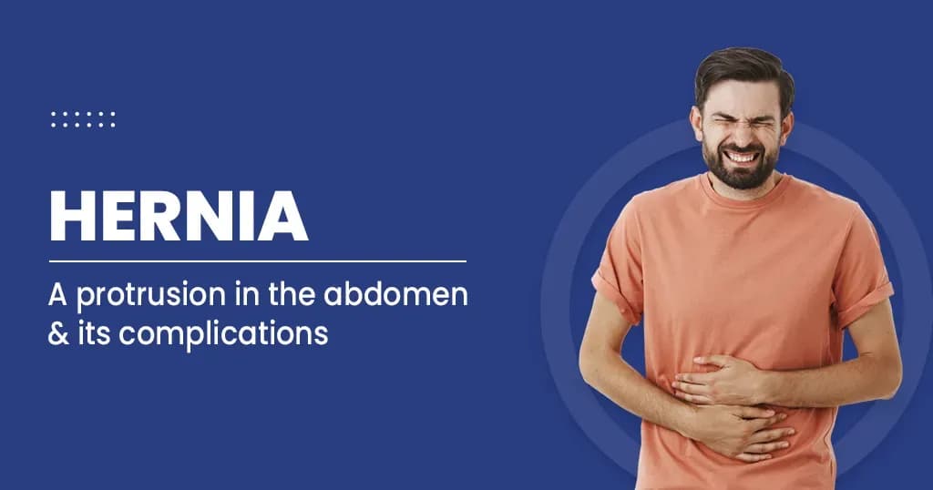 Hernia Causes 