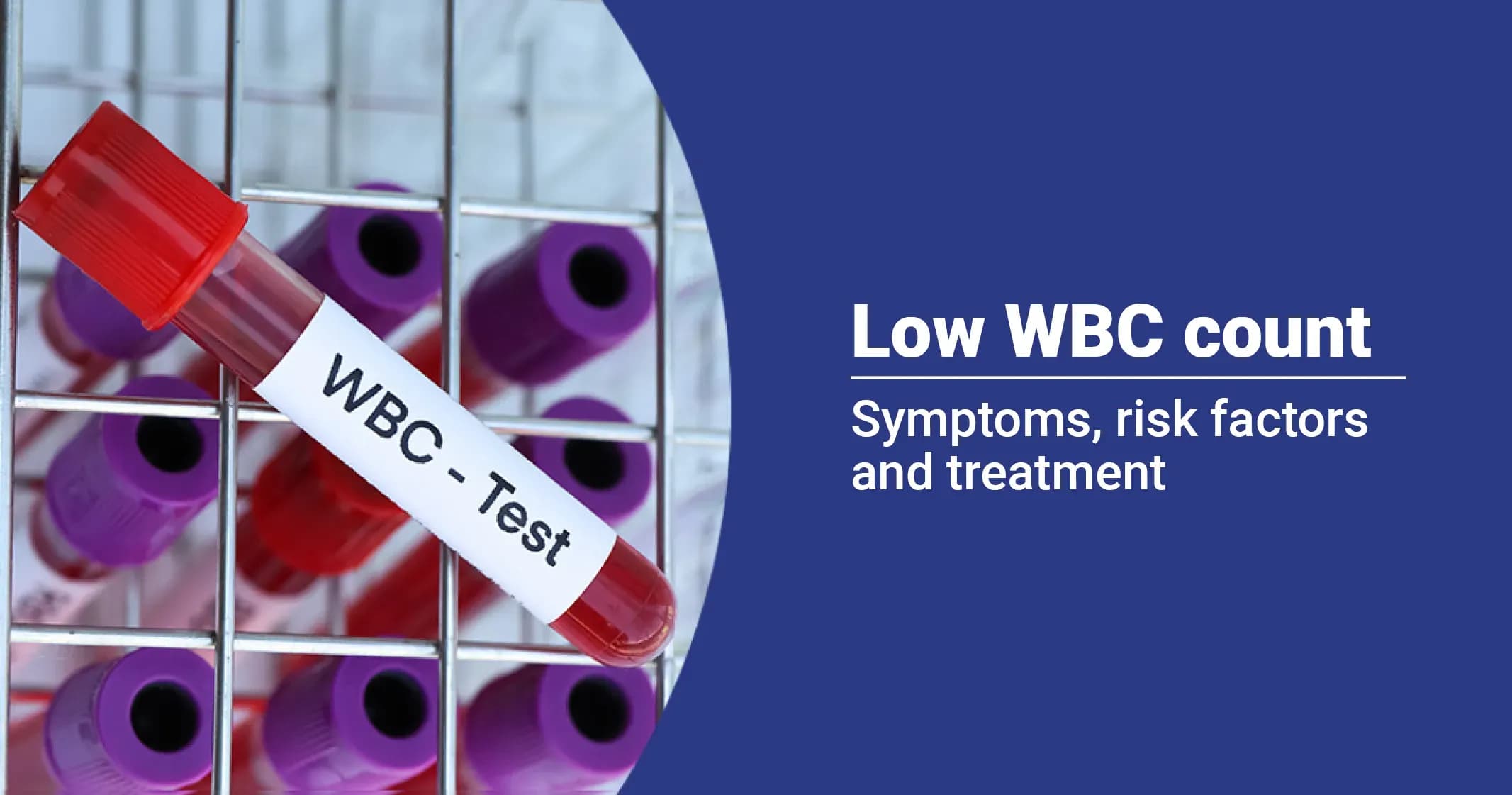 Dangers of Low White Blood Cell Counts: How to protect yourself?  
