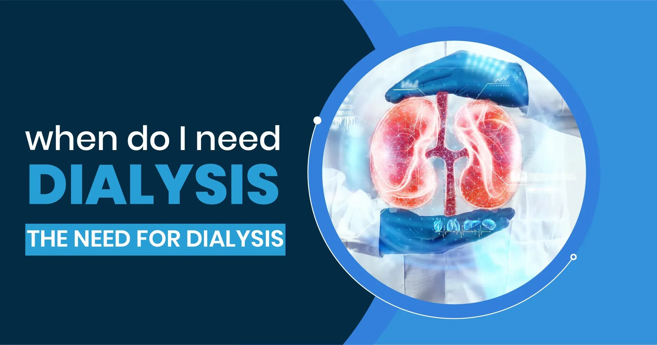 When Do I Need Dialysis? 