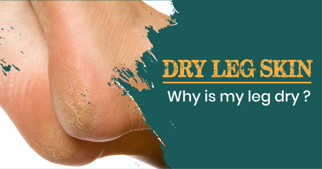 Dry Leg skin