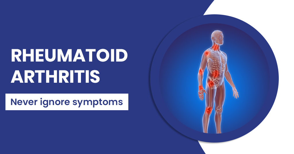 Rhematoid-arthritis