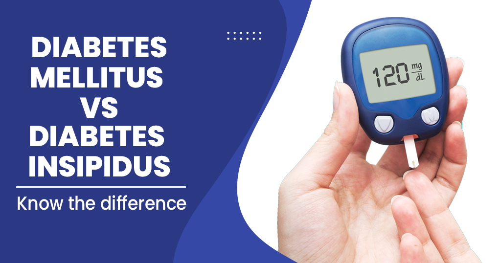 Insipidus diabetes Diabetes Insipidus: